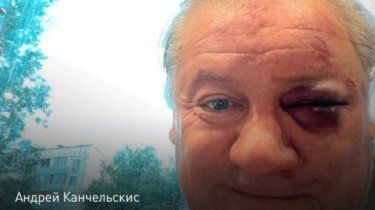 Отправили в нокаут? Экс-директор "Тобола" рассказал о том, как был избит