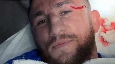 Претендент на пояс UFC снял швы перед боем садовыми ножницами (видео)