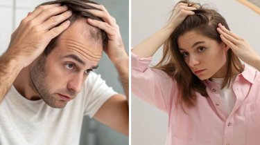 Врач объяснил, когда выпадение волос сигналит о скрытой онкологии